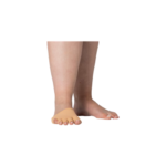 JOBST® Elvarex® Plus