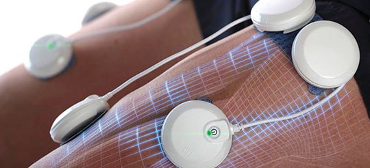 revolution-wireless-electrodes